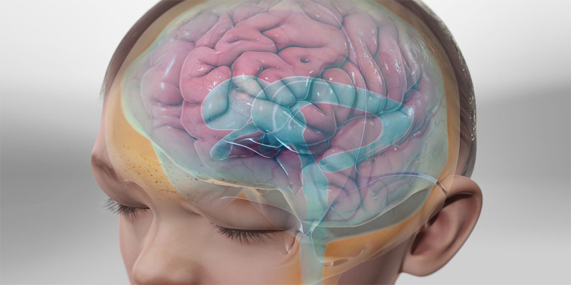 هیدروسفالی چیست و راه های درمان ان چه میدانید